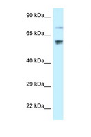 RSL1D1 Antibody - RSL1D1 antibody Western blot of HeLa Cell lysate. Antibody concentration 1 ug/ml.  This image was taken for the unconjugated form of this product. Other forms have not been tested.