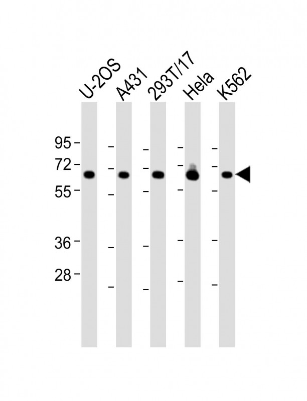 RSL1D1 Antibody - All lanes: Anti-RSL1D1 Antibody (C-Term) at 1:2000 dilution Lane 1: U-2OS whole cell lysate Lane 2: A431 whole cell lysate Lane 3: 293T/17 whole cell lysate Lane 4: Hela whole cell lysate Lane 5: K562 whole cell lysate Lysates/proteins at 20 µg per lane. Secondary Goat Anti-Rabbit IgG, (H+L), Peroxidase conjugated at 1/10000 dilution. Predicted band size: 55 kDa Blocking/Dilution buffer: 5% NFDM/TBST.
