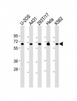 RSL1D1 Antibody - All lanes: Anti-RSL1D1 Antibody (C-Term) at 1:2000 dilution Lane 1: U-2OS whole cell lysate Lane 2: A431 whole cell lysate Lane 3: 293T/17 whole cell lysate Lane 4: Hela whole cell lysate Lane 5: K562 whole cell lysate Lysates/proteins at 20 µg per lane. Secondary Goat Anti-Rabbit IgG, (H+L), Peroxidase conjugated at 1/10000 dilution. Predicted band size: 55 kDa Blocking/Dilution buffer: 5% NFDM/TBST.
