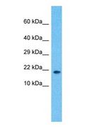 RSL24D1 Antibody - Western blot of RLP24 Antibody with human MCF7 Whole Cell lysate.  This image was taken for the unconjugated form of this product. Other forms have not been tested.