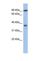 RSPH10B Antibody - RSPH10B antibody Western blot of Jurkat lysate. This image was taken for the unconjugated form of this product. Other forms have not been tested.