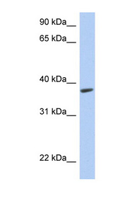 RSPH14 / RTDR1 Antibody - RTDR1 antibody Western blot of Fetal Muscle lysate. This image was taken for the unconjugated form of this product. Other forms have not been tested.