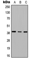 RSPH14 / RTDR1 Antibody - Western blot analysis of RTDR1 expression in HEK293T (A); Raw264.7 (B); PC12 (C) whole cell lysates.