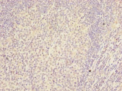 RSPH14 / RTDR1 Antibody - Immunohistochemistry of paraffin-embedded human tonsil using antibody at dilution of 1:100.