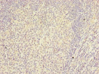 RSPH14 / RTDR1 Antibody - Immunohistochemistry of paraffin-embedded human tonsil tissue using RSPH14 Antibody at dilution of 1:100