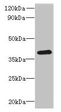 RSPH14 / RTDR1 Antibody - Western blot All lanes: RSPH14 antibody at 8µg/ml + 293T whole cell lysate Secondary Goat polyclonal to rabbit IgG at 1/10000 dilution Predicted band size: 39 kDa Observed band size: 39 kDa