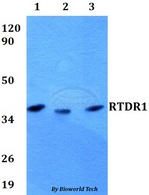 RSPH14 / RTDR1 Antibody - Western blot of RTDR1 antibody at 1:500 dilution. Lane 1: HEK293T whole cell lysate. Lane 2: Raw264.7 whole cell lysate. Lane 3: PC12 whole cell lysate.