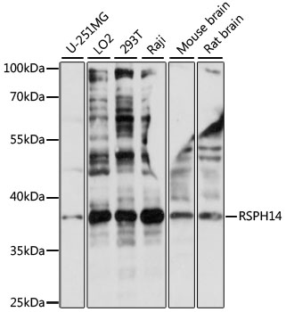 RSPH14 / RTDR1 Antibody - Western blot analysis of extracts of various cell lines, using RSPH14 antibody at 1:1000 dilution. The secondary antibody used was an HRP Goat Anti-Rabbit IgG (H+L) at 1:10000 dilution. Lysates were loaded 25ug per lane and 3% nonfat dry milk in TBST was used for blocking. An ECL Kit was used for detection and the exposure time was 5s.