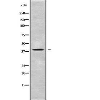 RSPH14 / RTDR1 Antibody - Western blot analysis of RTDR1 using HT29 whole cells lysates