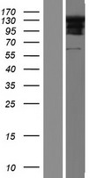RSPH4A Protein - Western validation with an anti-DDK antibody * L: Control HEK293 lysate R: Over-expression lysate