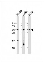 RSPO1 / RSPO Antibody - All lanes: Anti-RSPO1 Antibody (C-Term) at 1:2000 dilution. Lane 1: HL-60 whole cell lysate. Lane 2: Jurkat whole cell lysate. Lane 3: K562 whole cell lysate Lysates/proteins at 20 ug per lane. Secondary Goat Anti-Rabbit IgG, (H+L), Peroxidase conjugated at 1:10000 dilution. Predicted band size: 29 kDa. Blocking/Dilution buffer: 5% NFDM/TBST.