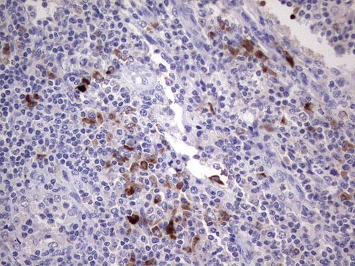RSPO1 / RSPO Antibody - Immunohistochemical staining of paraffin-embedded Human lymph node tissue within the normal limits using anti-RSPO1 mouse monoclonal antibody. (Heat-induced epitope retrieval by 1 mM EDTA in 10mM Tris, pH8.5, 120C for 3min,