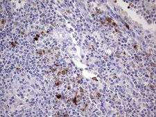 RSPO1 / RSPO Antibody - Immunohistochemical staining of paraffin-embedded Human lymph node tissue within the normal limits using anti-RSPO1 mouse monoclonal antibody. (Heat-induced epitope retrieval by 1 mM EDTA in 10mM Tris, pH8.5, 120C for 3min,