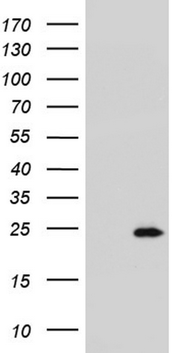 RSPO1 / RSPO Antibody - HEK293T cells were transfected with the pCMV6-ENTRY control (Left lane) or pCMV6-ENTRY RSPO1 (Right lane) cDNA for 48 hrs and lysed. Equivalent amounts of cell lysates (5 ug per lane) were separated by SDS-PAGE and immunoblotted with anti-RSPO1.