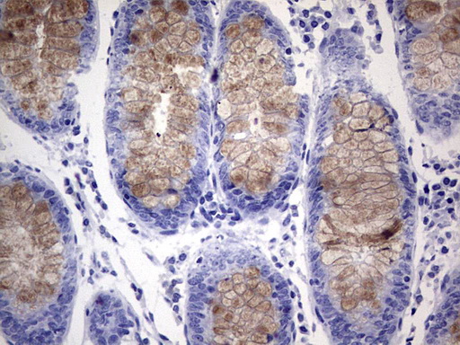 RSPO1 / RSPO Antibody - Immunohistochemical staining of paraffin-embedded Human colon tissue within the normal limits using anti-RSPO1 mouse monoclonal antibody. (Heat-induced epitope retrieval by 1 mM EDTA in 10mM Tris, pH8.5, 120C for 3min,