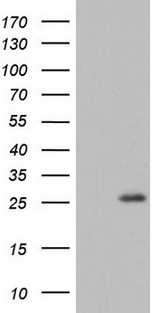 RSPO1 / RSPO Antibody - HEK293T cells were transfected with the pCMV6-ENTRY control. (Left lane) or pCMV6-ENTRY RSPO1. (Right lane) cDNA for 48 hrs and lysed. Equivalent amounts of cell lysates. (5 ug per lane) were separated by SDS-PAGE and immunoblotted with anti-RSPO1.
