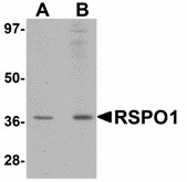 RSPO1 / RSPO Antibody - Western blot of RSPO1 in rat spleen tissue lysate with RSPO1 antibody at (A) 1 and (B) 2 ug/ml.
