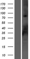 RSPO2 Protein - Western validation with an anti-DDK antibody * L: Control HEK293 lysate R: Over-expression lysate