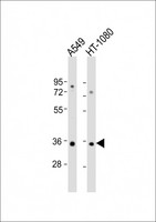 RSPO3 Antibody - All lanes: Anti-RSPO3 Antibody (C-Term) at 1:2000 dilution. Lane 1: A549 whole cell lysate. Lane 2: HT-1080 whole cell lysate Lysates/proteins at 20 ug per lane. Secondary Goat Anti-Rabbit IgG, (H+L), Peroxidase conjugated at 1:10000 dilution. Predicted band size: 31 kDa. Blocking/Dilution buffer: 5% NFDM/TBST.