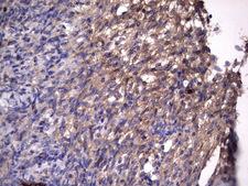 RSPO3 Antibody - Immunohistochemical staining of paraffin-embedded Human Ovary tissue within the normal limits using anti-RSPO3 mouse monoclonal antibody. (Heat-induced epitope retrieval by 1 mM EDTA in 10mM Tris, pH8.5, 120C for 3min,