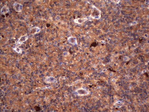 RSPO3 Antibody - Immunohistochemical staining of paraffin-embedded Human lymph node tissue within the normal limits using anti-RSPO3 mouse monoclonal antibody. (Heat-induced epitope retrieval by 1 mM EDTA in 10mM Tris, pH8.5, 120C for 3min,