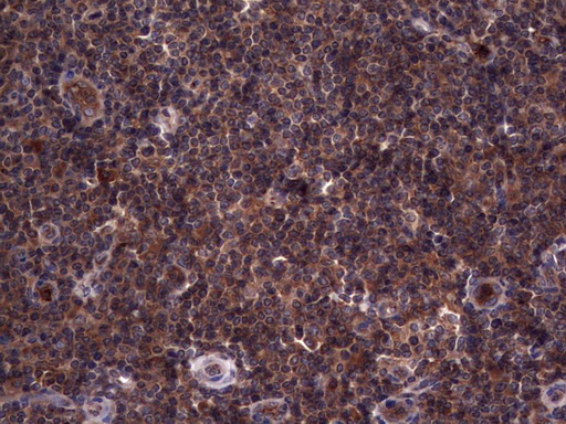 RSPO3 Antibody - Immunohistochemical staining of paraffin-embedded Human tonsil within the normal limits using anti-RSPO3 mouse monoclonal antibody. (Heat-induced epitope retrieval by 1 mM EDTA in 10mM Tris, pH8.5, 120C for 3min,