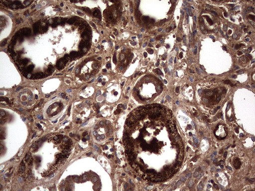 RSPO3 Antibody - Immunohistochemical staining of paraffin-embedded Human Kidney tissue within the normal limits using anti-RSPO3 mouse monoclonal antibody. (Heat-induced epitope retrieval by 1 mM EDTA in 10mM Tris, pH8.5, 120C for 3min,