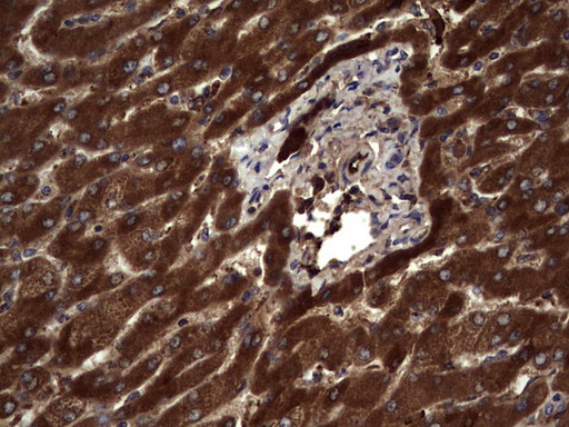 RSPO3 Antibody - Immunohistochemical staining of paraffin-embedded Human liver tissue within the normal limits using anti-RSPO3 mouse monoclonal antibody. (Heat-induced epitope retrieval by 1 mM EDTA in 10mM Tris, pH8.5, 120C for 3min,