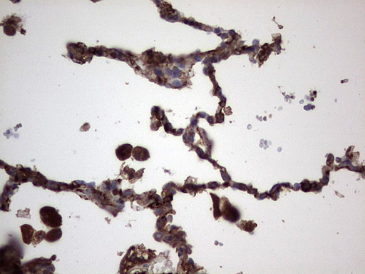 RSPO3 Antibody - Immunohistochemical staining of paraffin-embedded Human lung tissue within the normal limits using anti-RSPO3 mouse monoclonal antibody. (Heat-induced epitope retrieval by 1 mM EDTA in 10mM Tris, pH8.5, 120C for 3min,
