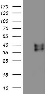 RSPO3 Antibody - HEK293T cells were transfected with the pCMV6-ENTRY control. (Left lane) or pCMV6-ENTRY RSPO3. (Right lane) cDNA for 48 hrs and lysed. Equivalent amounts of cell lysates. (5 ug per lane) were separated by SDS-PAGE and immunoblotted with anti-RSPO3.