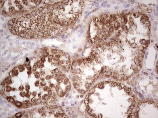 RSPO3 Antibody - Immunohistochemical staining of paraffin-embedded Human Kidney tissue within the normal limits using anti-RSPO3 mouse monoclonal antibody.  heat-induced epitope retrieval by 1 mM EDTA in 10mM Tris, pH8.5, 120C for 3min)