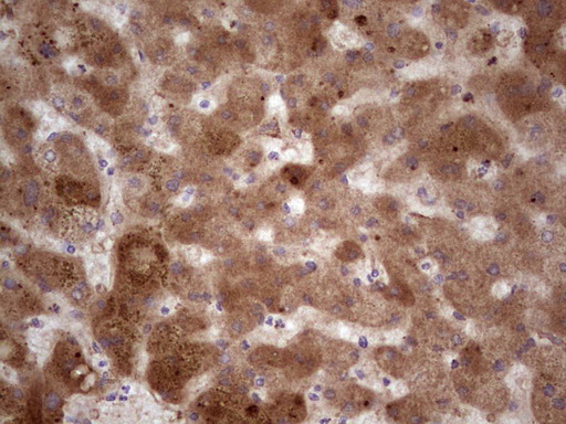RSPO3 Antibody - Immunohistochemical staining of paraffin-embedded Human liver tissue within the normal limits using anti-RSPO3 mouse monoclonal antibody.  heat-induced epitope retrieval by 1 mM EDTA in 10mM Tris, pH8.5, 120C for 3min)