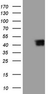 RSPO3 Antibody - HEK293T cells were transfected with the pCMV6-ENTRY control. (Left lane) or pCMV6-ENTRY RSPO3. (Right lane) cDNA for 48 hrs and lysed. Equivalent amounts of cell lysates. (5 ug per lane) were separated by SDS-PAGE and immunoblotted with anti-RSPO3. (1:500)