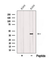 RSPO3 Antibody - Western blot analysis of extracts of A549 cells using RSPO3 antibody. The lane on the left was treated with blocking peptide.