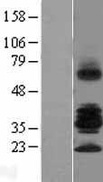 RSPO3 Protein - Western validation with an anti-DDK antibody * L: Control HEK293 lysate R: Over-expression lysate