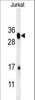 RSPO4 Antibody - RSPO4 Antibody western blot of Jurkat cell line lysates (15 ug/lane). The RSPO4 antibody detected the RSPO4 protein (arrow).