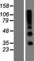 RSPO4 Protein - Western validation with an anti-DDK antibody * L: Control HEK293 lysate R: Over-expression lysate