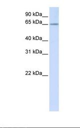 RSPRY1 Antibody - Placenta lysate. Antibody concentration: 1.0 ug/ml. Gel concentration: 12%.  This image was taken for the unconjugated form of this product. Other forms have not been tested.