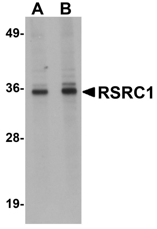 RSRC1 Antibody - Western blot analysis of RSRC1 in HepG2 cell lysate with RSRC1 antibody at (A) 1 and (B) 2 ug/ml.