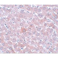 RSRC1 Antibody - Immunohistochemistry of RSRC1 in rat liver tissue with RSRC1 antibody at 5 µg/mL.