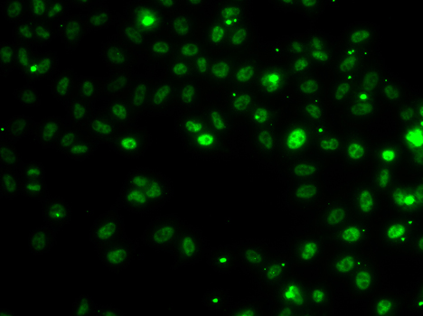 RSRC1 Antibody - Immunofluorescence analysis of MCF7 cells.
