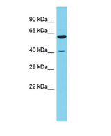 RSRC1 Antibody - Western blot of RSRC1 Antibody - N-terminal region with human 721_B cells lysate.  This image was taken for the unconjugated form of this product. Other forms have not been tested.