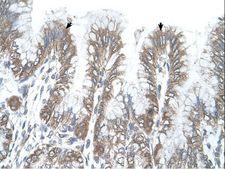 RSRC2 Antibody - RSRC2 antibody RSRC2(arginine/serine-rich coiled-coil 2) Antibody was used in IHC to stain formalin-fixed, paraffin-embedded human stomach.  This image was taken for the unconjugated form of this product. Other forms have not been tested.