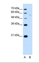 RSRC2 Antibody - Lane A: Marker. Lane B: Jurkat cell lysate. Antibody concentration: 2.5 ug/ml. Gel concentration: 12%.  This image was taken for the unconjugated form of this product. Other forms have not been tested.