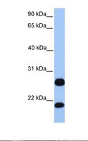 RSRP1 Antibody - HepG2 cell lysate. Antibody concentration: 1.0 ug/ml. Gel concentration: 12%.  This image was taken for the unconjugated form of this product. Other forms have not been tested.