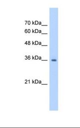 RSU1 Antibody - Jurkat cell lysate. Antibody concentration: 1.25 ug/ml. Gel concentration: 12%.  This image was taken for the unconjugated form of this product. Other forms have not been tested.
