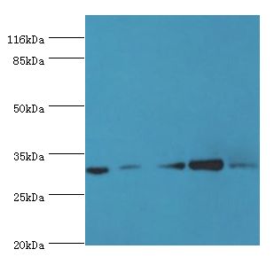 RSU1 Antibody - Western blot. All lanes: RSU1 antibody at 2 ug/ml. Lane 1: mouse placenta tissue Lane 2: caco2 whole cell lysate Lane 3: Jurkat whole cell lysate Lane 4: HepG2 whole cell lysate Lane 5: mouse brain tissue. Secondary antibody: goat polyclonal to rabbit at 1:10000 dilution p.  This image was taken for the unconjugated form of this product. Other forms have not been tested.