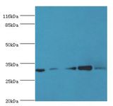 RSU1 Antibody - Western blot. All lanes: RSU1 antibody at 2 ug/ml. Lane 1: mouse placenta tissue Lane 2: caco2 whole cell lysate Lane 3: Jurkat whole cell lysate Lane 4: HepG2 whole cell lysate Lane 5: mouse brain tissue. Secondary antibody: goat polyclonal to rabbit at 1:10000 dilution p.  This image was taken for the unconjugated form of this product. Other forms have not been tested.