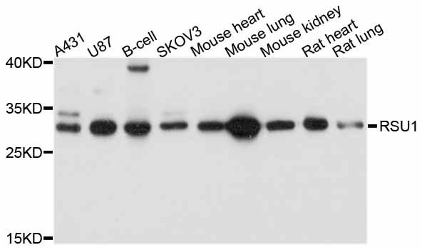 RSU1 Antibody - Western blot analysis of extracts of various cell lines, using RSU1 antibody at 1:1000 dilution. The secondary antibody used was an HRP Goat Anti-Rabbit IgG (H+L) at 1:10000 dilution. Lysates were loaded 25ug per lane and 3% nonfat dry milk in TBST was used for blocking. An ECL Kit was used for detection and the exposure time was 5s.