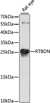 RTBDN / Retbindin Antibody - Western blot analysis of extracts of rat eye, using RTBDN antibody at 1:1000 dilution. The secondary antibody used was an HRP Goat Anti-Rabbit IgG (H+L) at 1:10000 dilution. Lysates were loaded 25ug per lane and 3% nonfat dry milk in TBST was used for blocking. An ECL Kit was used for detection and the exposure time was 10s.